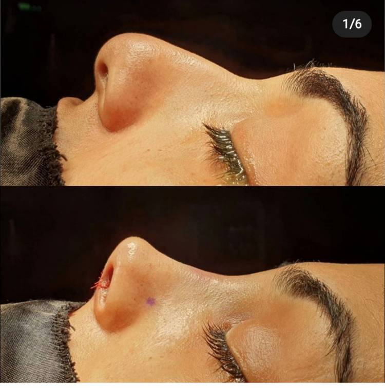 DOÇ.DR. YAKUP YEGİN KBB  kulak burun boğaz  ameliyatlarında harikalar yaratmaya devam ediyor 